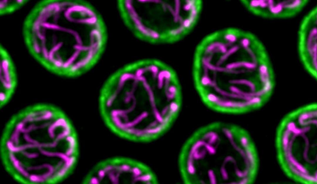 Microscopic image of C. elegans oocytes, with chromosomes illuminated in purple and the nuclear envelope in green. 