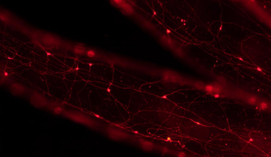 Tentacles of Nematostella with subpopulation of neurons expressing red fluorescent protein