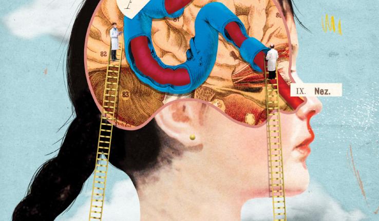 Illustration of nose bleed