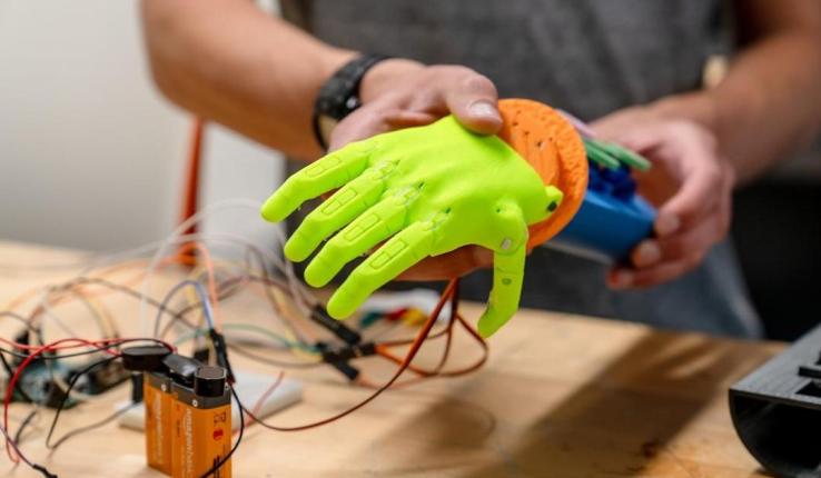 3d printed prosthetic limb
