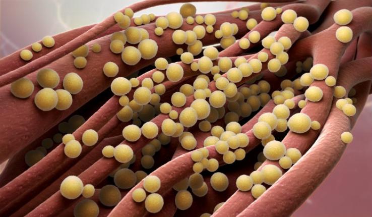 Representation of Staphylococcus aureus